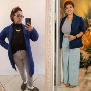 Antes e depois Camila
